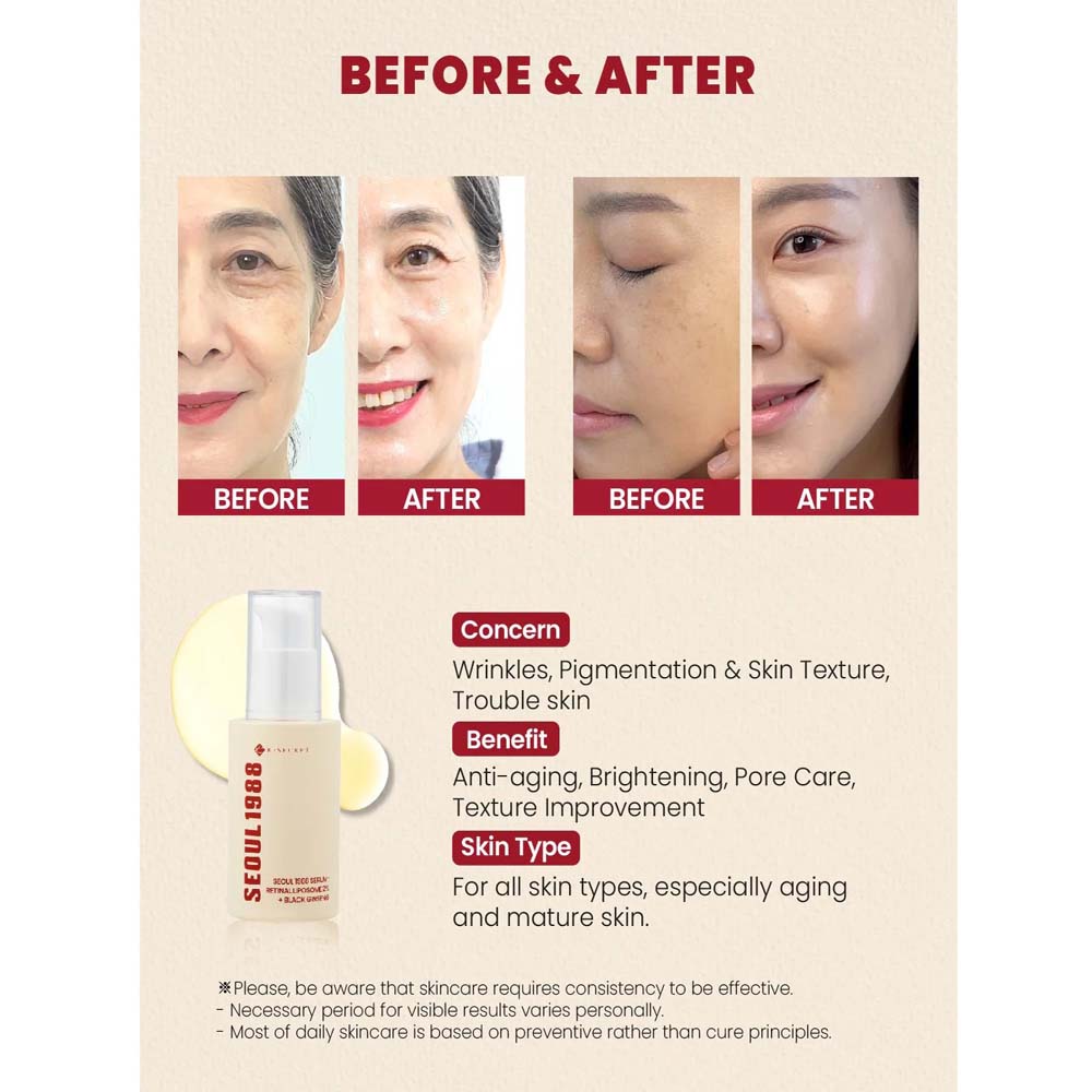 K-Secret SEOUL 1988 Serum with Retinal Liposome 2% & Black Ginseng – Anti-Aging, Wrinkle Care, Brightening & Firming Korean Face Serum 30ml
