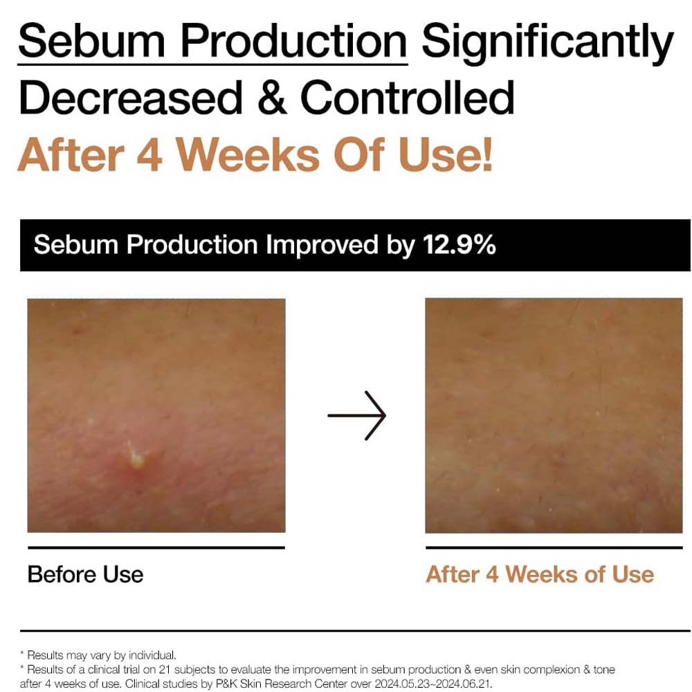 ANUA Rice 70 Grow Milky Toner 250ml - Korean Moisturizing Lotion for Brightening, Hydration & Smooth Skin Tone