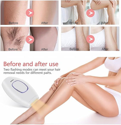 Home Use IPL Beauty Device – Permanent Hair Removal for Whole Body, Painless Laser Hair Removal Device for Women and Men