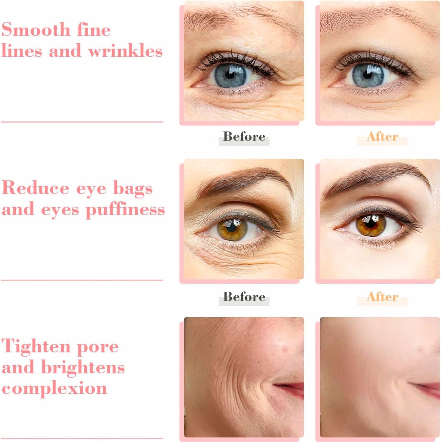 2-Pcs Facial Ice Globes. Cryo roller balls to reduce puffiness, dark circles & wrinkles. Cold therapy facial massager.