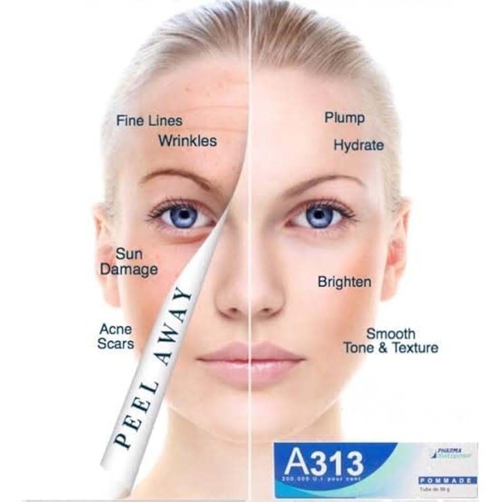 A313 Vitamin A Pommade. French pharmaceutical retinoid ointment for anti-aging, wrinkles & skin renewal. 50g tube.