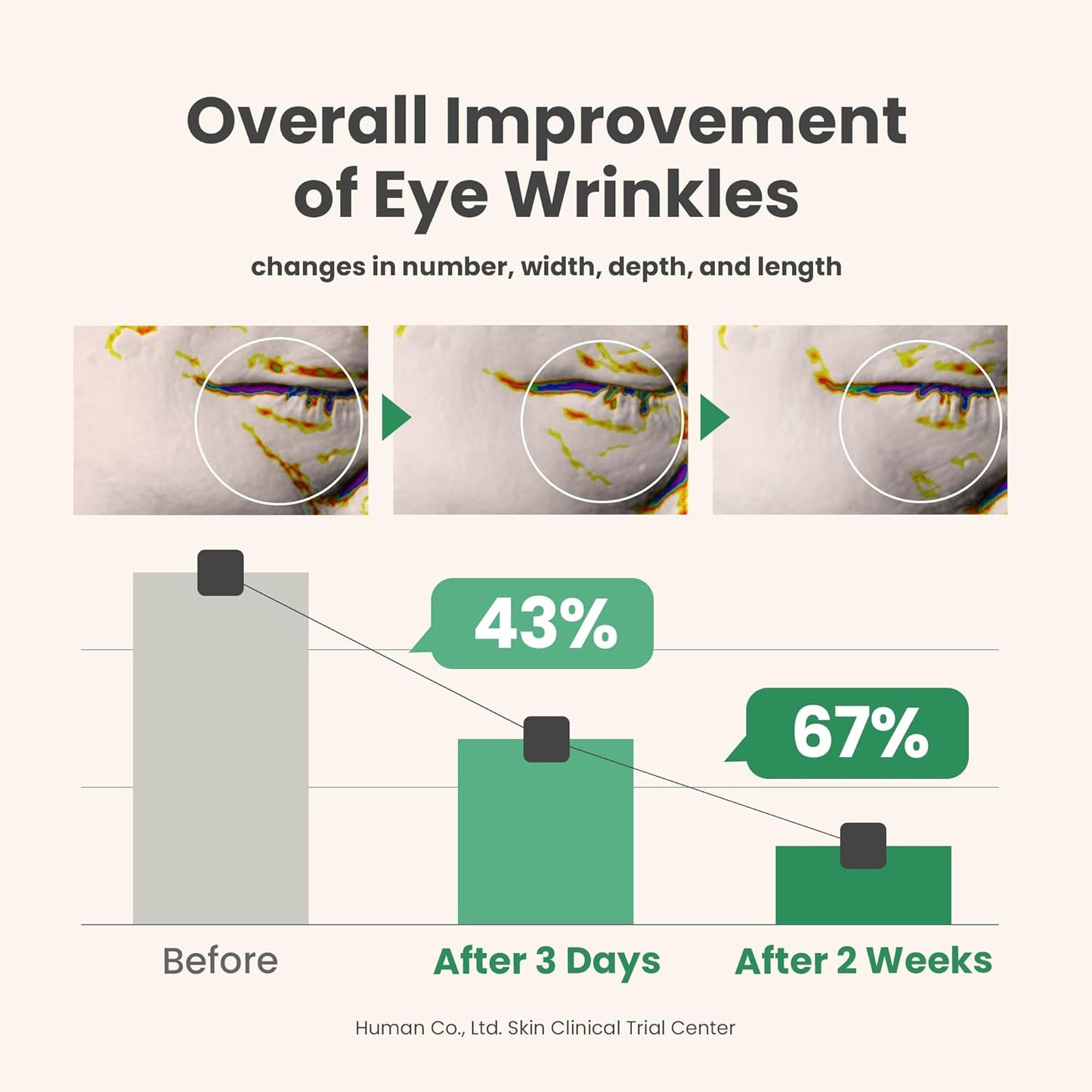 AXIS-Y Vegan Collagen Eye Serum – Korean Eye Treatment with Triple Hyaluronic Acid & Peptides, Reduces Fine Lines, Dark Circles & Boosts Elasticity