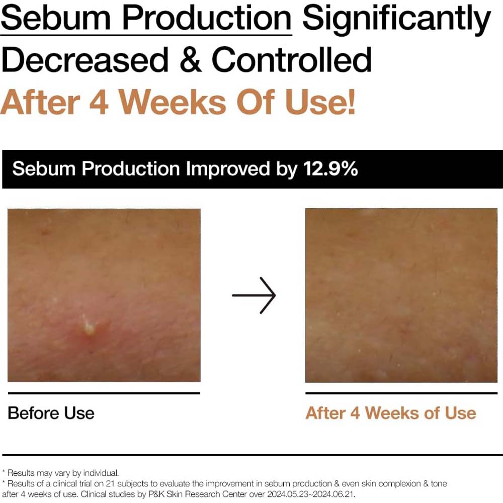 ANUA Rice 70 Glow Milky Toner. Nourishing rice water toner for glass skin. With Niacinamide & Ceramides. 250ml.