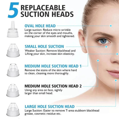Electric Blackhead Vacuum Remover - Pore Cleanser & Pimple Sucker for Spa-Quality Facial at Home
