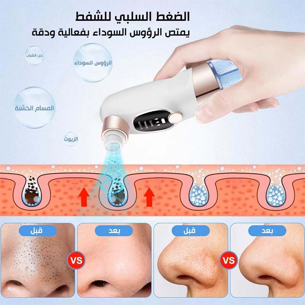 Blackhead Suction Remover Vacuum Pore Cleaner. Electric facial tool for deep cleaning blackheads & unclogging pores. Waterproof.