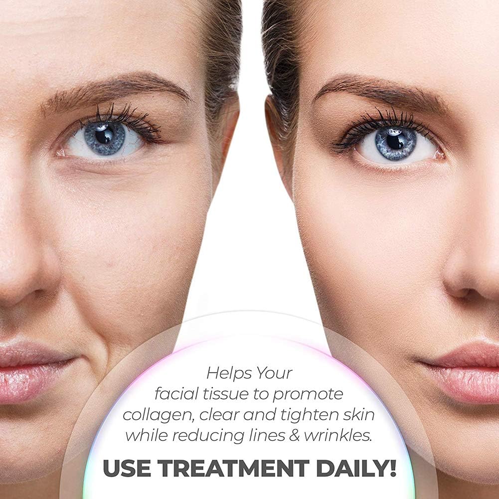 7-LED Whitening Face Mask | Advanced Optical Therapy for Radiant Skin | White/Black | 230x200mm