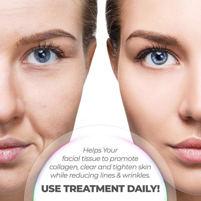 7-LED Whitening Face Mask | Advanced Optical Therapy for Radiant Skin | White/Black | 230x200mm