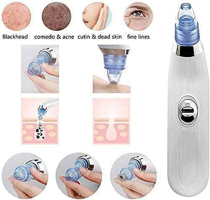 Blackhead & Whitehead Remover Electric Facial Beauty Machine | Your At-Home Spa Experience | Deep Cleansing and Pore Purifying Tool