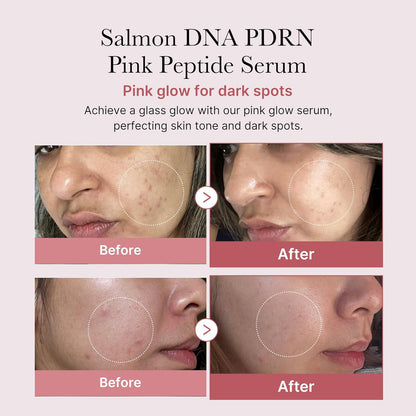 Medicube PDRN Pink Peptide Serum with Niacinamide for firming, hydrating & brightening skin tone. Korean glow serum.