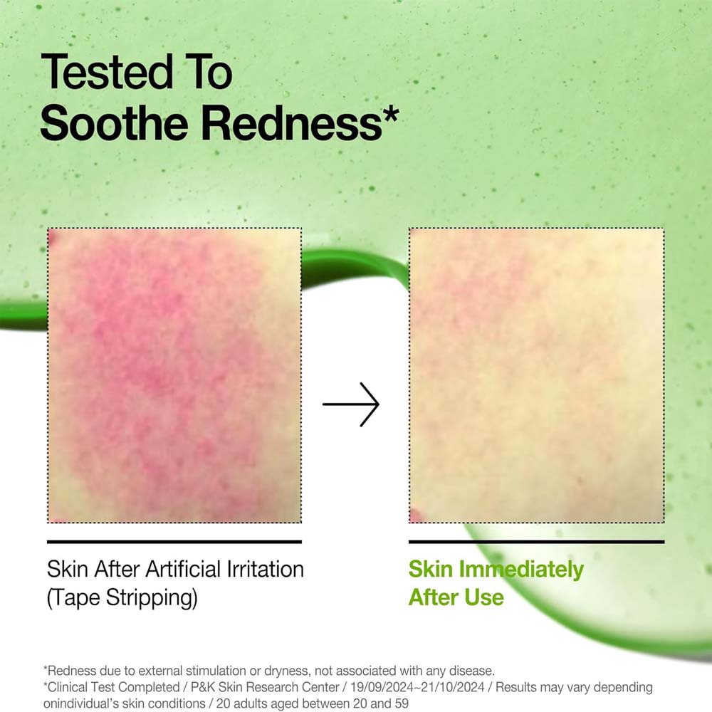 Anua Azelaic Acid 10 Soothing Serum with Hyaluronic Acid & Niacinamide for redness-prone, sensitive skin. Vegan Korean skincare.